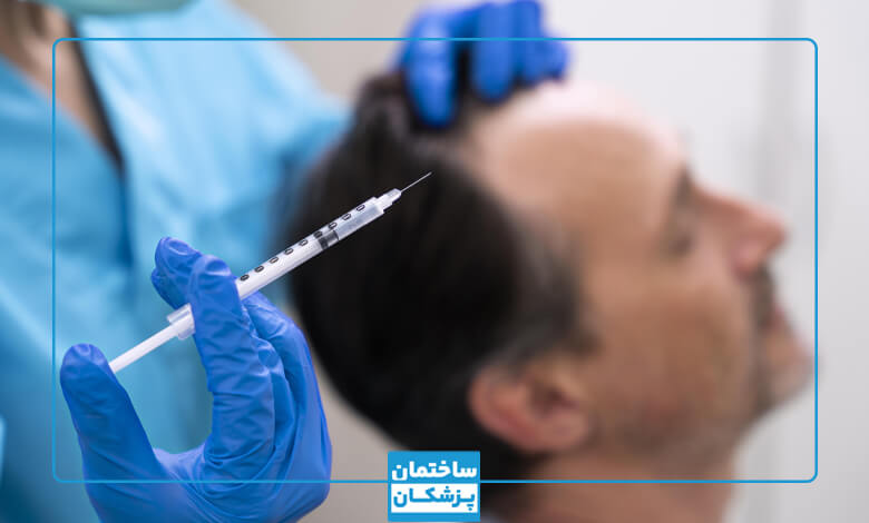 هزینه مزوتراپی مو در غرب تهران چقدر است؟