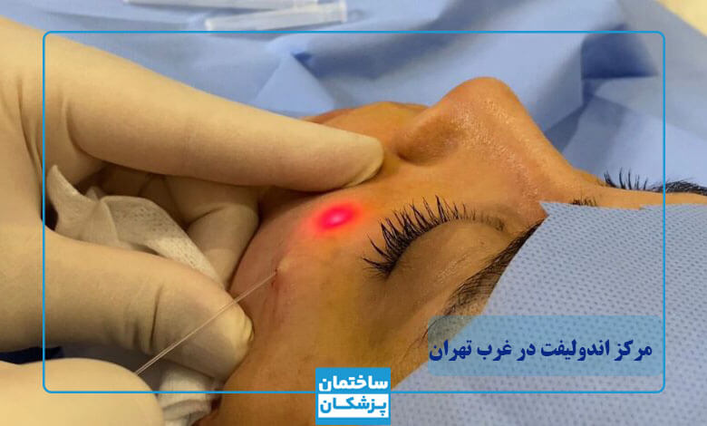 کاندیدای مناسب اندولیفت صورت