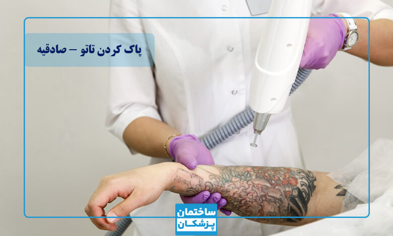 مشخصات بهترین مرکز پاک کردن تاتو با لیزر در صادقیه
