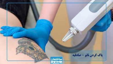 بهترین مرکز پاک کردن تاتو با لیزر در صادقیه