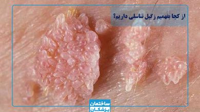 از کجا بفهمیم زگیل تناسلی داریم - تشخیص زگیل تناسلی