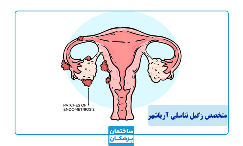 معرفی بهترین متخصص زگیل تناسلی در آریاشهر