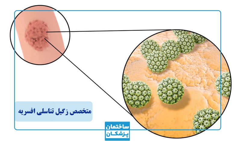 بهترین متخصص زگیل تناسلی در افسریه