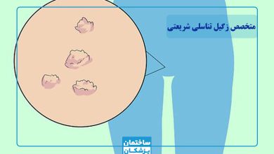 بهترین متخصص زگیل تناسلی در شریعتی