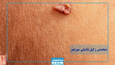 بهترین متخصص زگیل تناسلی در مهرشهر کیست