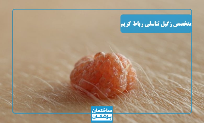 بهترین متخصص زگیل تناسلی در رباط کریم