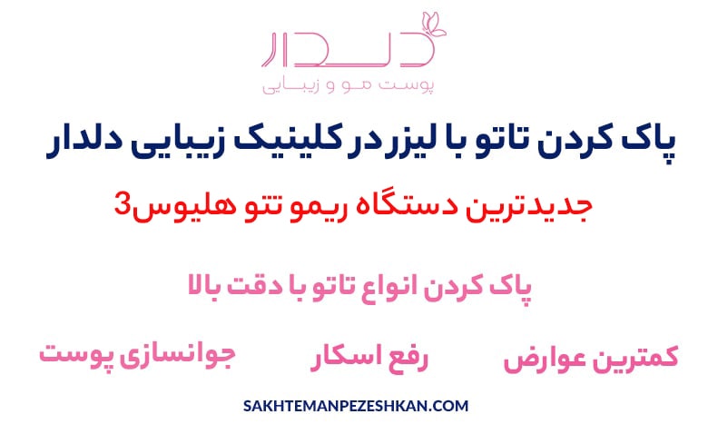 پاک کردن تاتو با لیزر در تهران