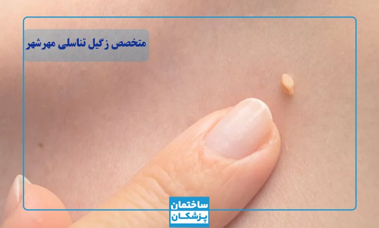 روش‌های درمان زگیل تناسلی در مهرشهر