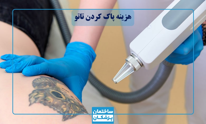 هزینه پاک کردن تاتو با لیزر در تهران