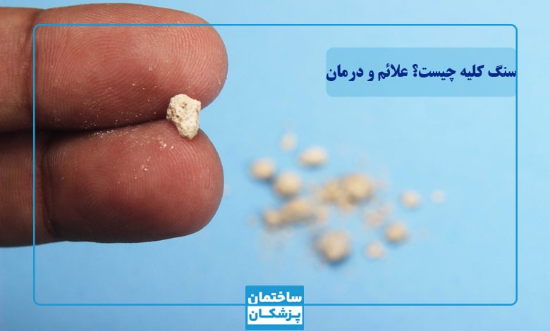 سنگ کلیه چیست