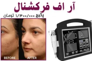 نمونه کار آر اف فرکشنال در مرکز زیبایی پرتو