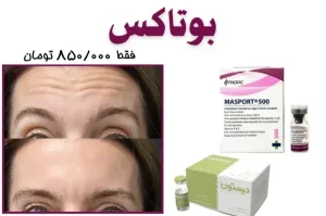 تزریق بوتاکس در کلینیک پرتو