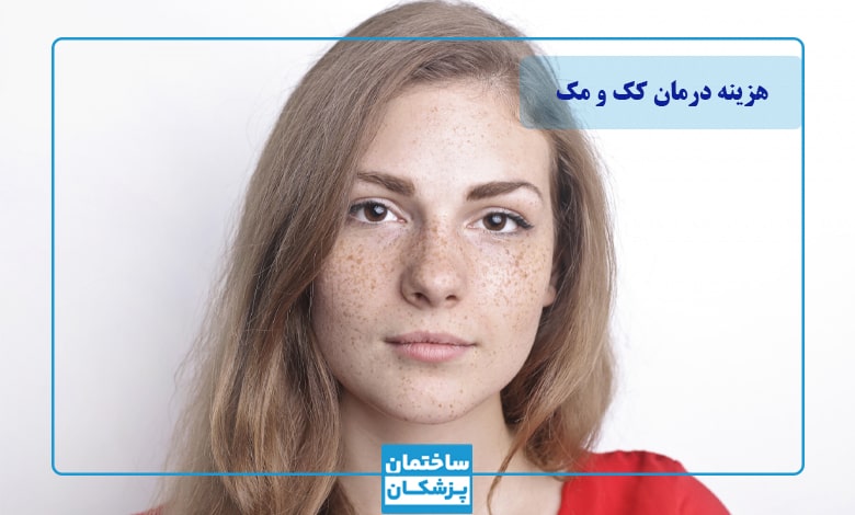 هزینه درمان کک و مک در تهران چقدر است؟