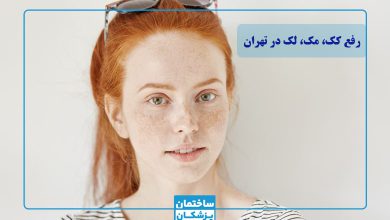 بهترین دکتر رفع کک و مک در تهران