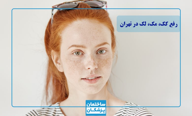 بهترین دکتر رفع کک و مک در تهران