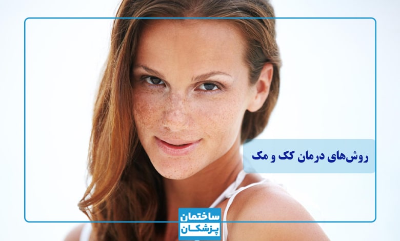 روش های درمان کک و مک صورت چیست