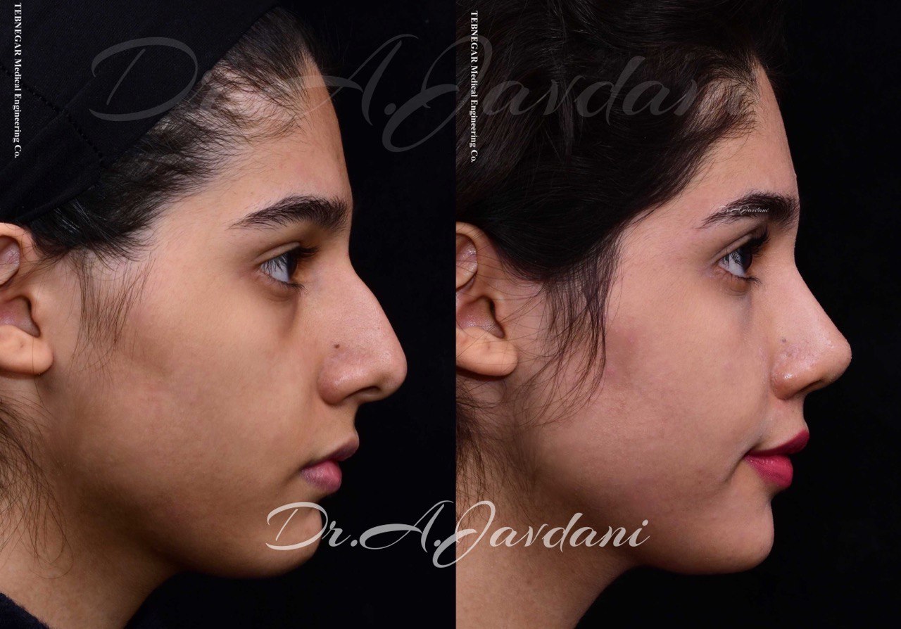 نمونه کار بینی طبیعی دکتر علی جاودانی 4