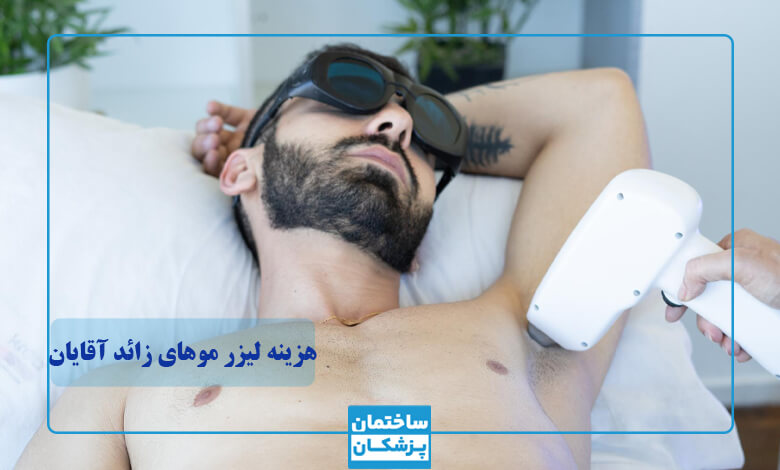 قیمت لیزر موهای زائد آقایان