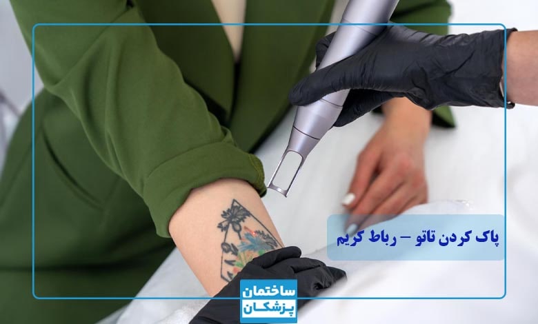 پاک کردن تاتو با لیزر در رباط کریم