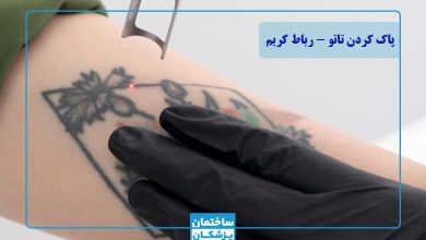 بهترین کلینیک پاک کردن تاتو در رباط کریم