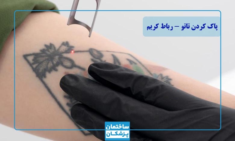 بهترین کلینیک پاک کردن تاتو در رباط کریم