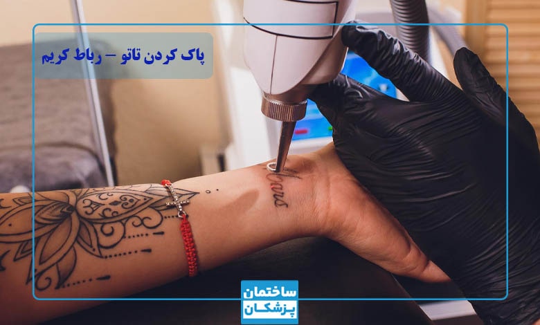 پاک کردن تاتو با لیزر چگونه است؟