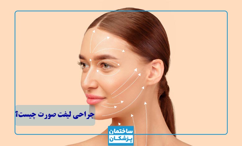 جراحی لیفت صورت چیست؟
