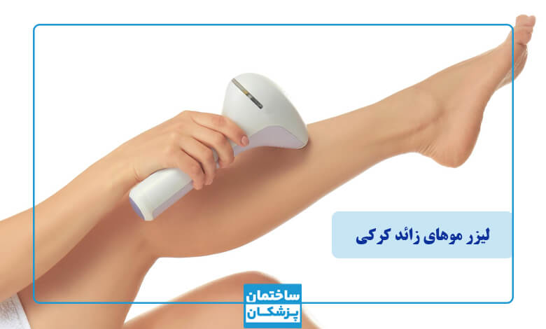 لیزر مو‌های کرکی بدن چیست؟