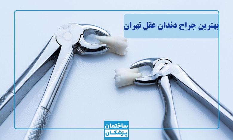 بهترین جراح دندان عقل در تهران