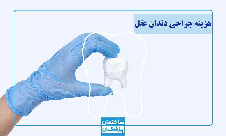هزینه جراحی دندان عقل در تهران