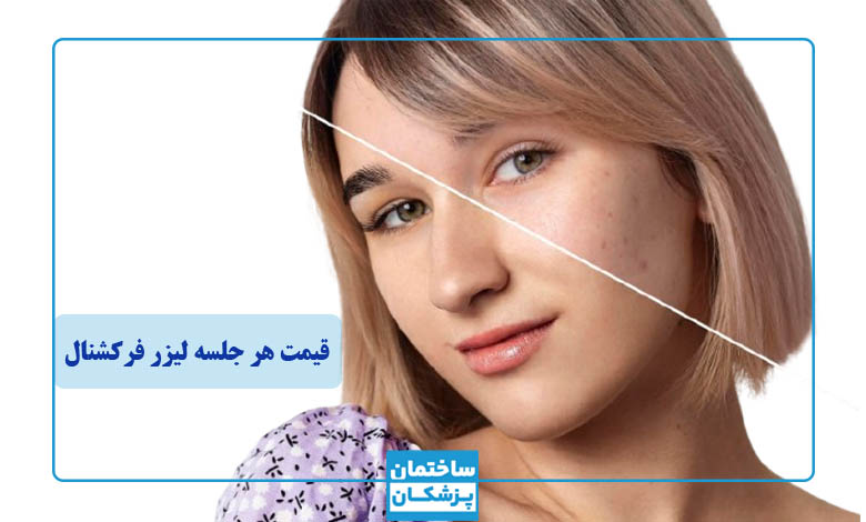 عوامل موثر بر قیمت لیزر فرکشنال Co2