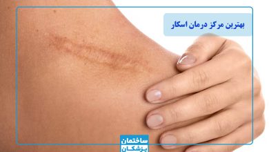 بهترین مرکز درمان اسکار در تهران