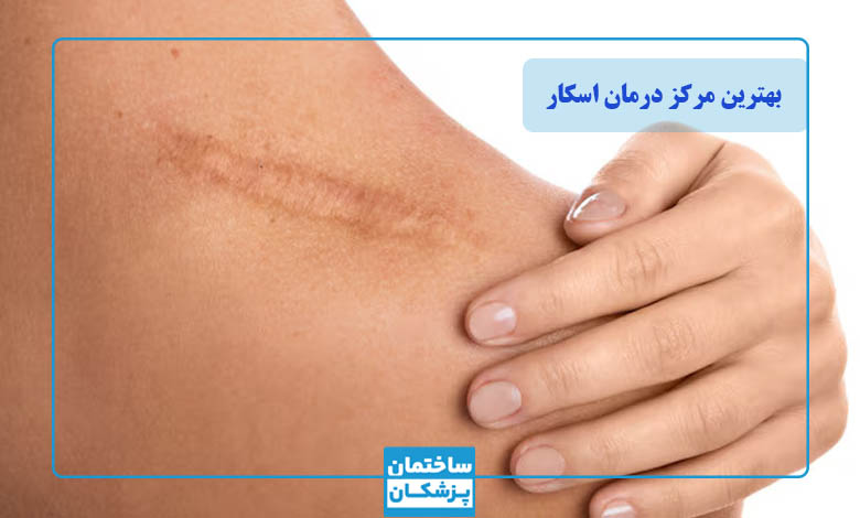 بهترین مرکز درمان اسکار در تهران