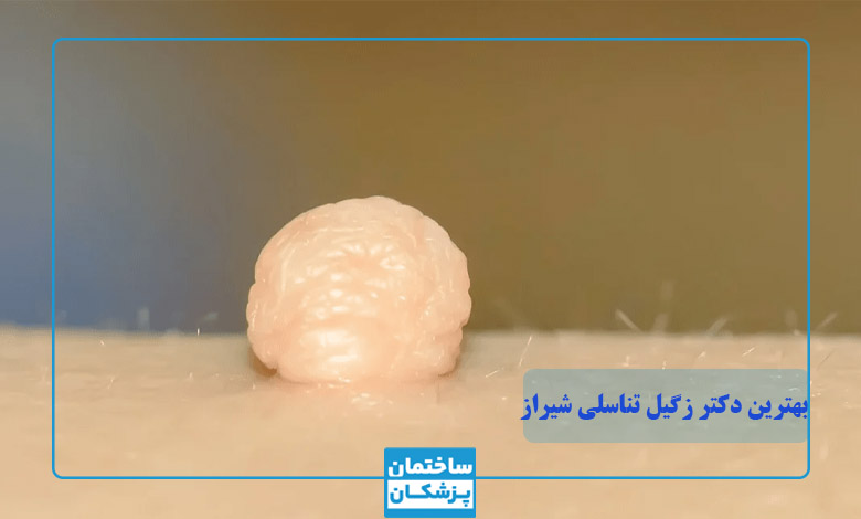 بهترین متخصص و دکتر زگیل تناسلی در شیراز
