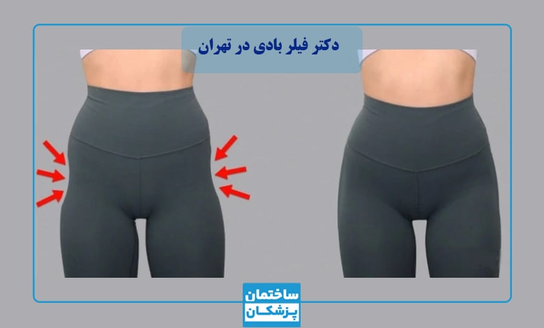 لیست بهترین دکتر فیلر بادی در تهران