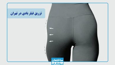 بهترین دکتر فیلر بادی در تهران
