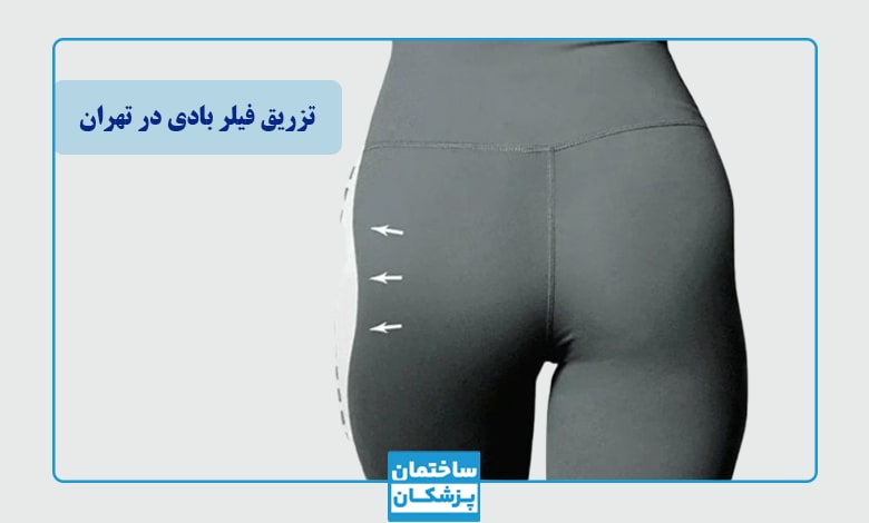 بهترین دکتر فیلر بادی در تهران