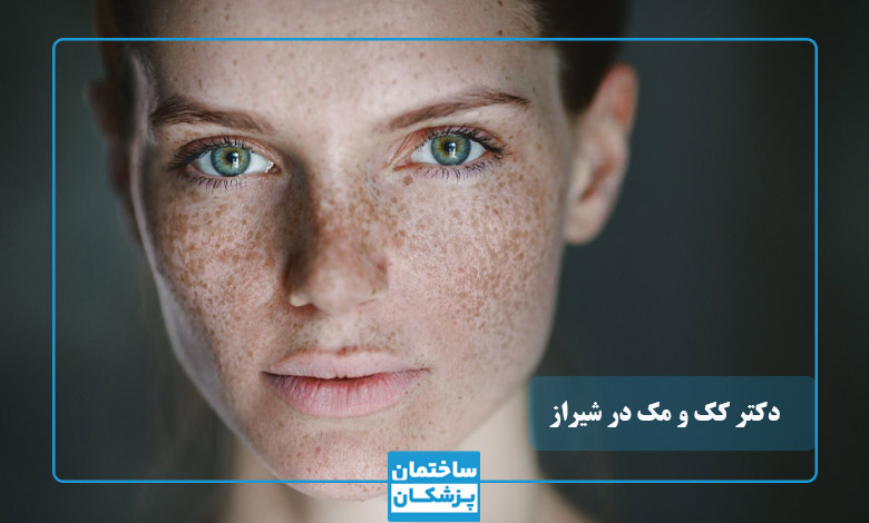 بهترین دکتر کک و مک در شیراز