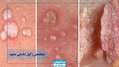 بهترین متخصص زگیل تناسلی در مشهد