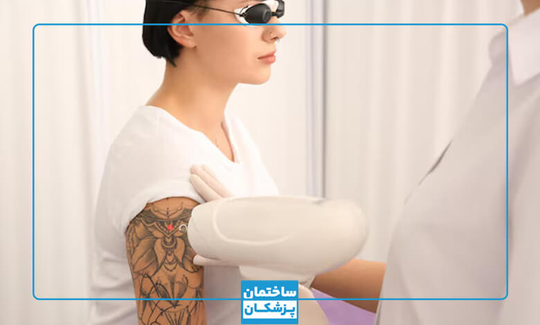 لیست بهترین کلینیکهای پاک کردن تاتو در سعادت آباد