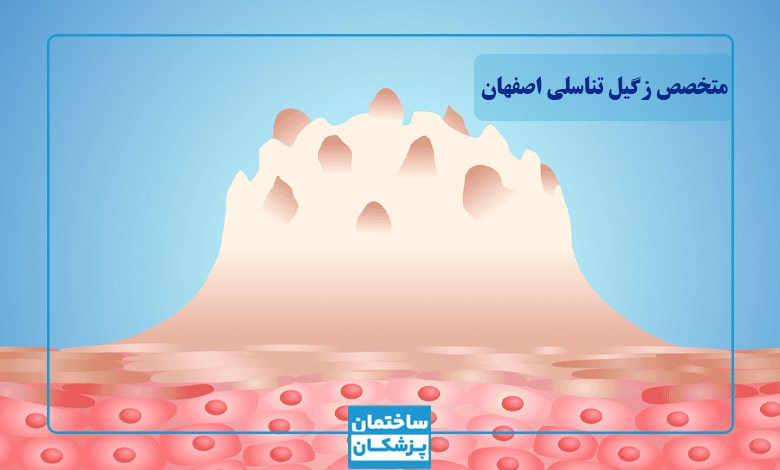هزینه لیزر و درمان زگیل تناسلی در اصفهان