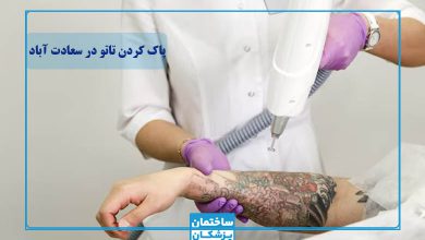 بهترین مرکز پاک کردن تاتو در سعادت آباد