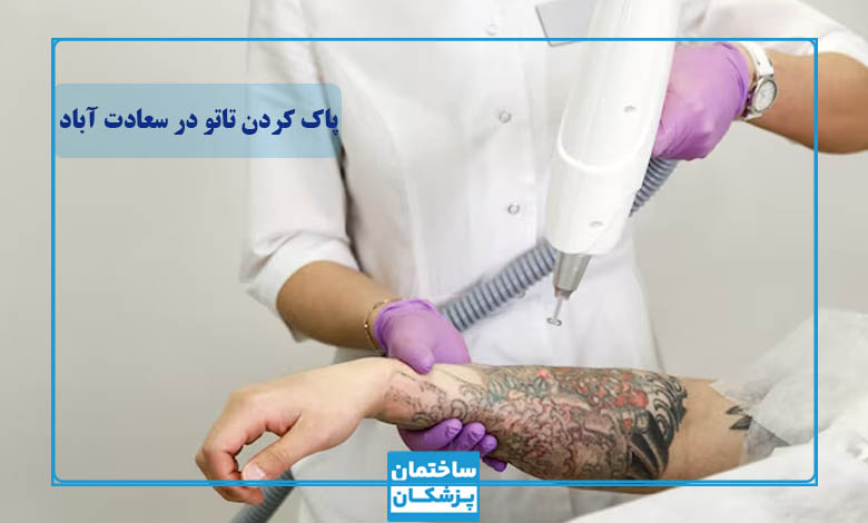 بهترین مرکز پاک کردن تاتو در سعادت آباد