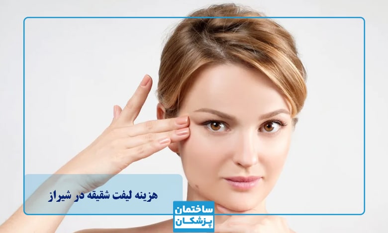 هزینه لیفت شقیقه در شیراز