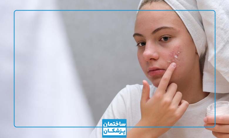 مراقبت های پوستی برای از بین بردن جوش در یک روز