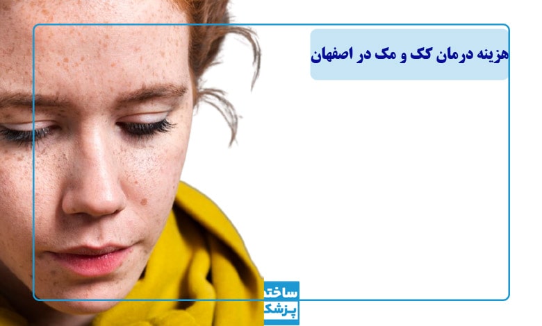 هزینه درمان کک و مک در اصفهان