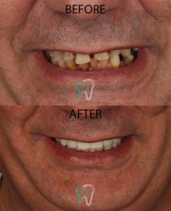 نمونه کار دندانپزشکی کلینیک رایا