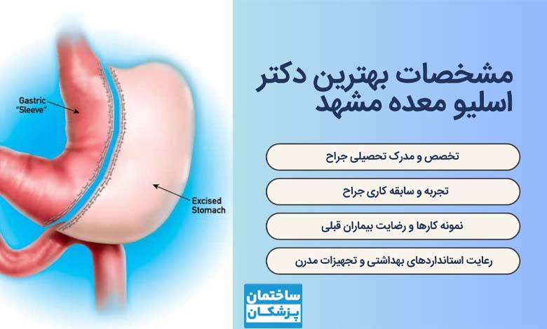 معیارهای مهم در انتخاب بهترین دکتر اسلیو معده در مشهد