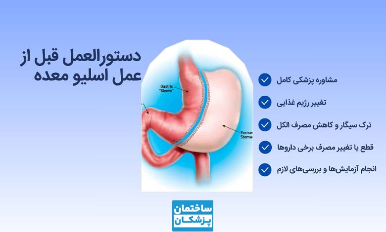آمادگی قبل از جراحی اسلیو معده؛ قبل از عمل چه کارهایی انجام دهیم؟