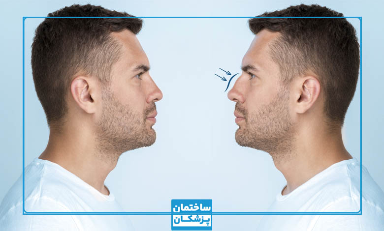 هزینه عمل بینی در اصفهان